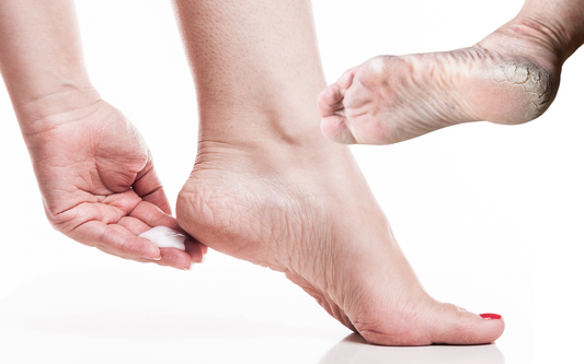 Calmipé – Creme Hidratante e Regenerador para Pés