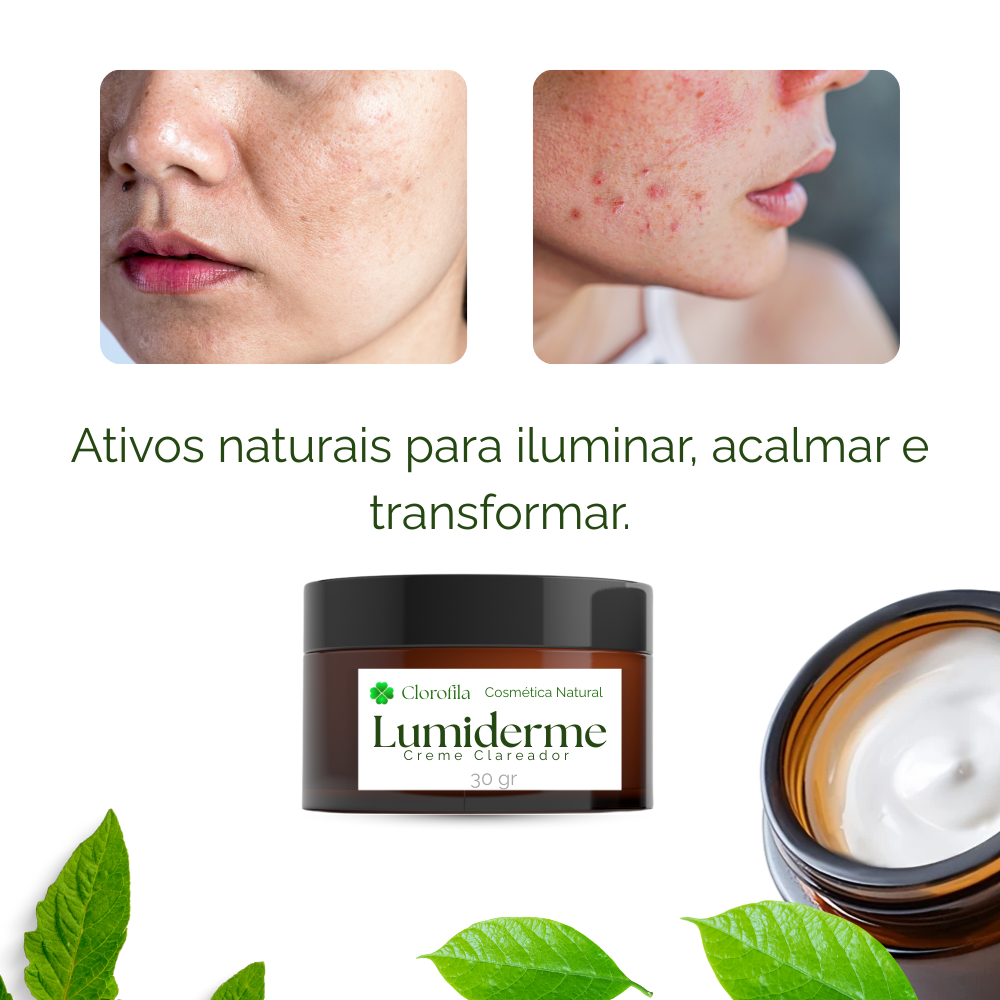 Lumiderme - Creme Facial Clareador de manchas
