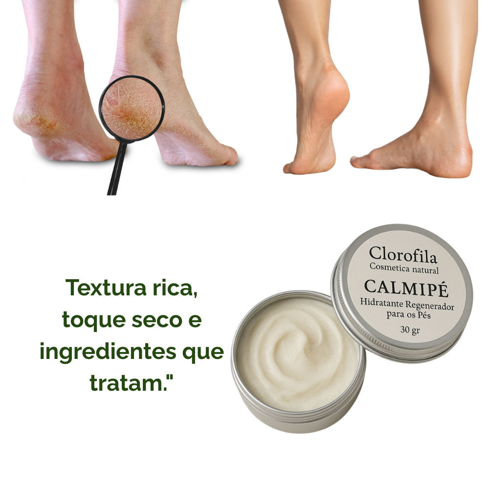 CalmiFoot