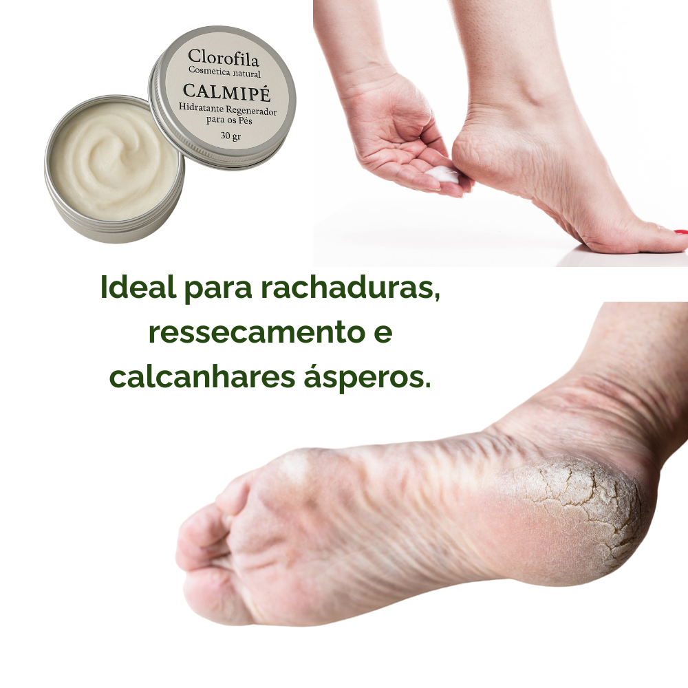 CalmiFoot