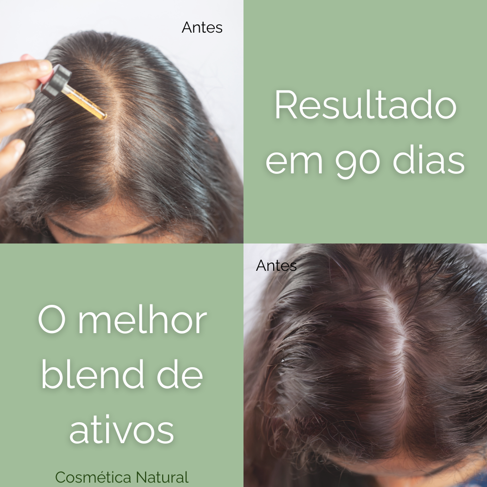 RaizFort - Hair Tonic